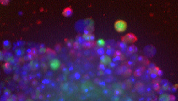 Leverage automated workflows to enable complex organoid assays