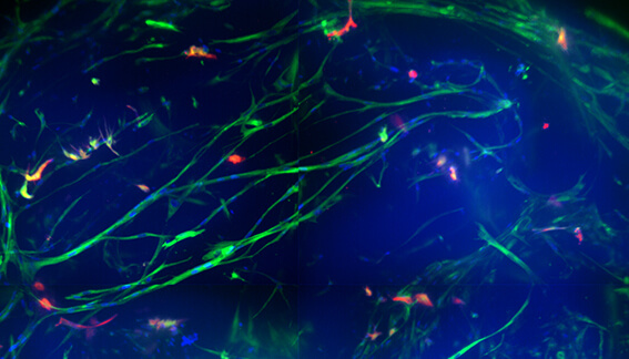 Novel analysis of neural outgrowth in 3D human brain micro-tissues with application in compound screening