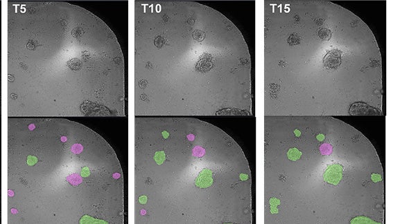 T cell-induced morphological change analysis of colorectal cancer organoids using AI