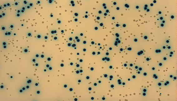 Monoclonal Antibodies (mAbs) Applications and Therapeutics