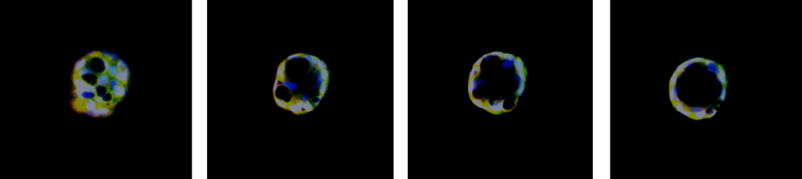 Confocal imaging and 3D image analysis of organoids