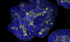 CUSTOM ORGANOID EXPANSION SERVICES
