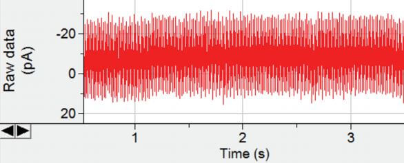 Electrical hum overwhelming a single-channel recording