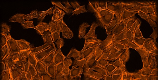 F-actin cytoskeleton, Golgi, plasma membrane Dye