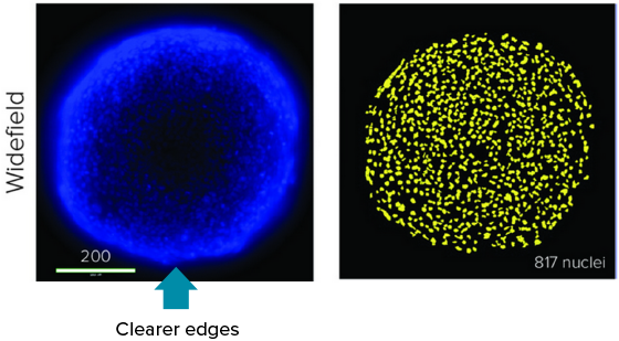 Confocal image