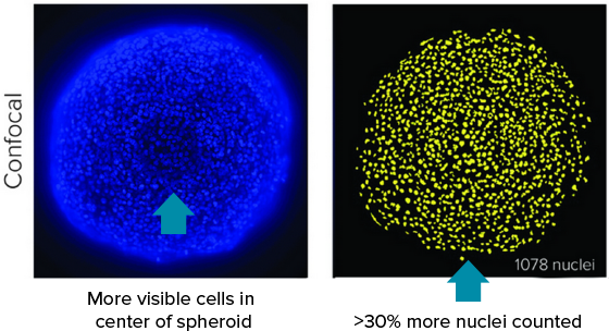 Confocal image