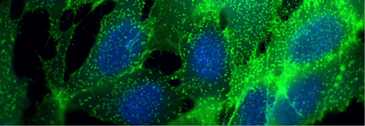 Time-Resolved Fluorescence TRF / TR-FRET (HTRF)