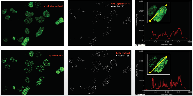 Digital Confocal Option sharpens intensity peaks of fluorescent objects