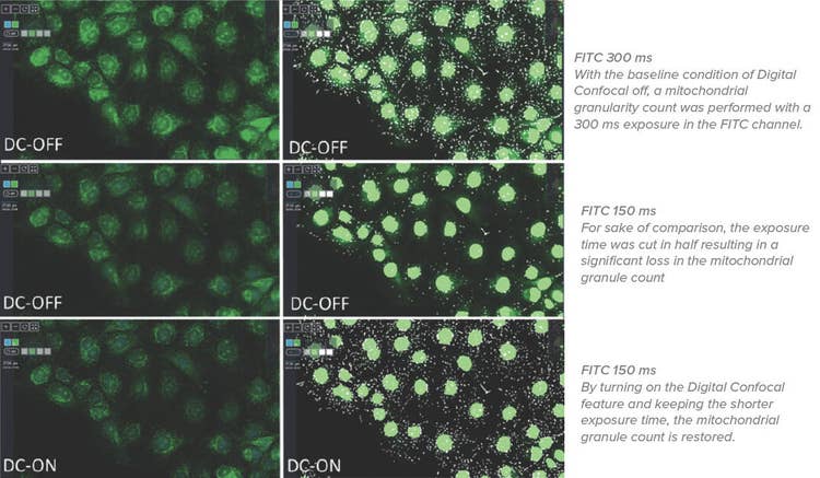 FITC Channel- ImageXpress Pico Digital Confocal uses AutoQuant 2D Real Time Deconvolution