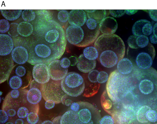 Confocal image of organoid culture